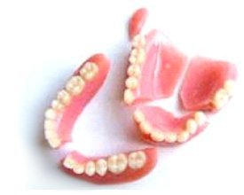 Image of dentures in need of repair
