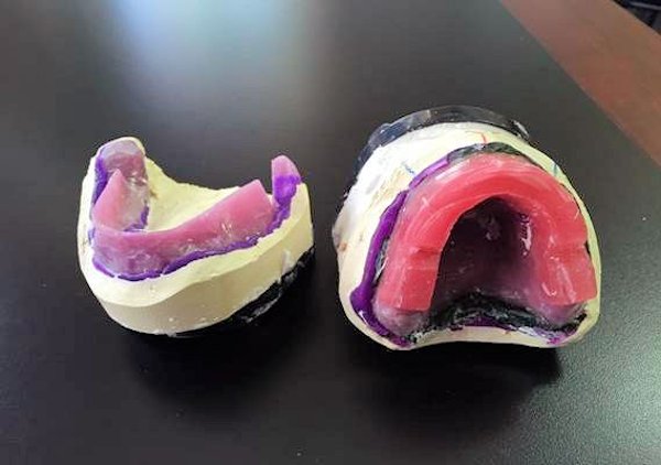 Image of Custom Bite Block