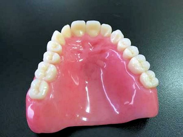 Image of Customized Lower Denture