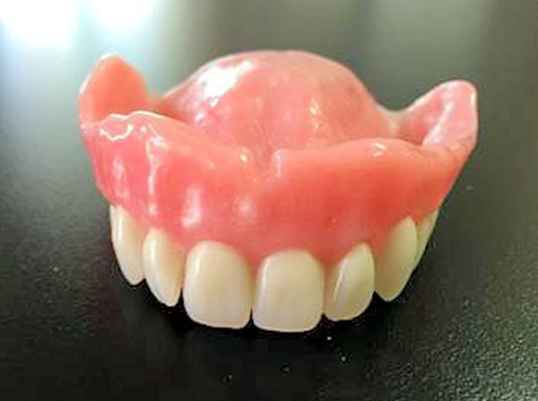 Image of Custom Upper Denture